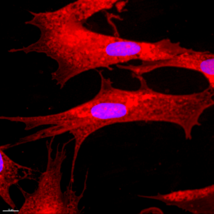 Stem Cells / fibroblasts